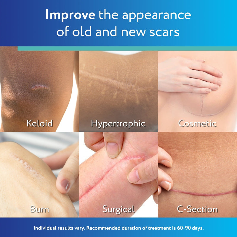 ✨ ScarAway Medical-Grade Silicone Clear Scar Sheet ✨ ( BUY 1 GET 1 FREE )
