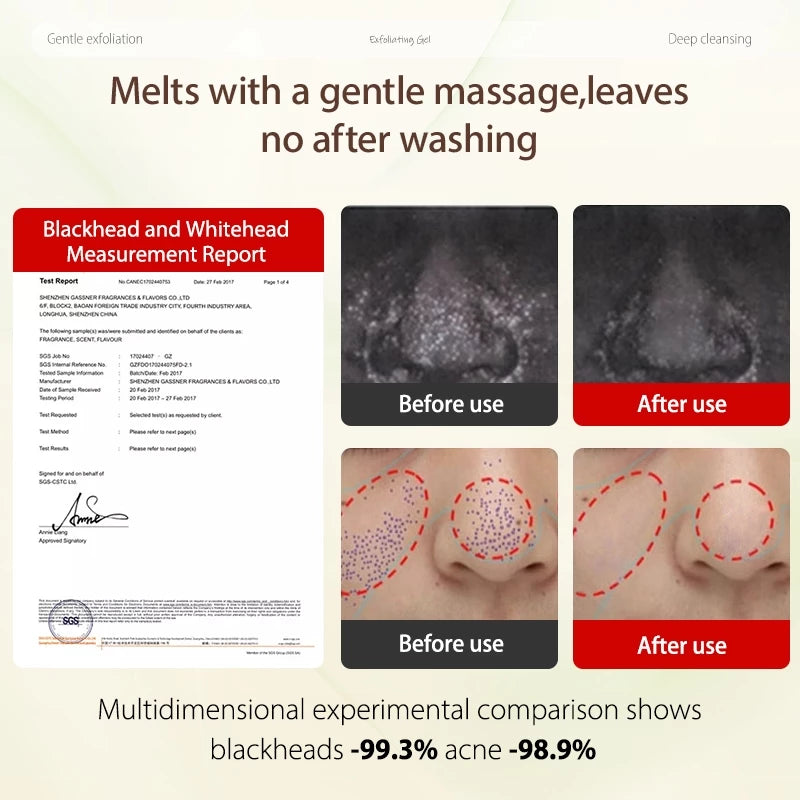 Exfoliating Face Scrub & Peeling Gel ( BUY 1 GET 1 FREE )