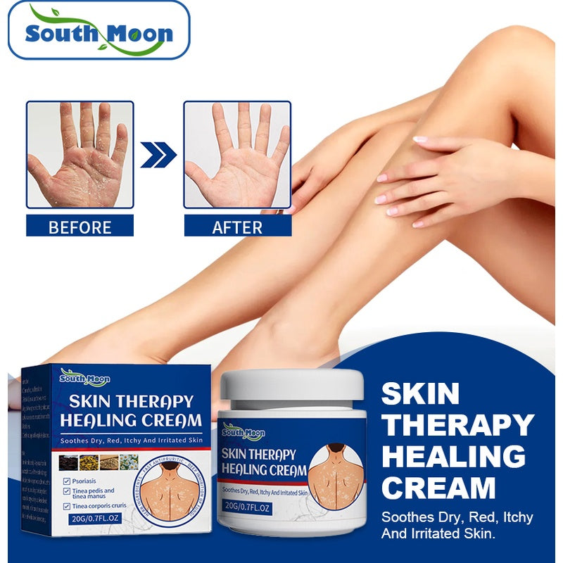 🌿✨ SOUTH MOON SKIN THERAPY HEALING CREAM ✨🌿 ( BUY 1 GET 1 FREE )
