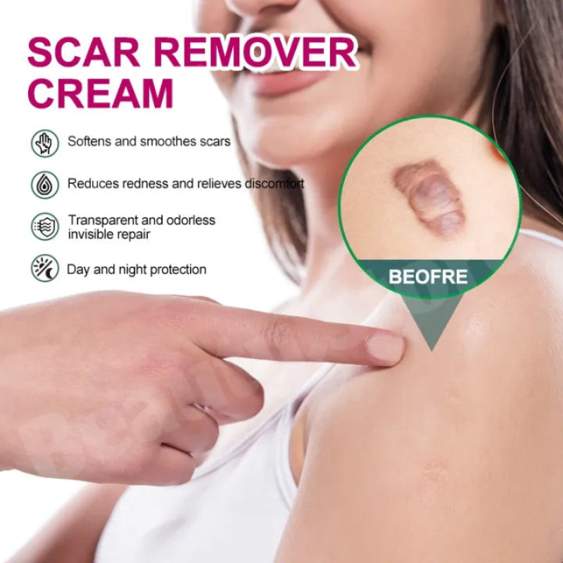 🌿✨ VERDEFY SCAR REMOVER CREAM ✨🌿 ( BUY 1 GET 1 FREE )