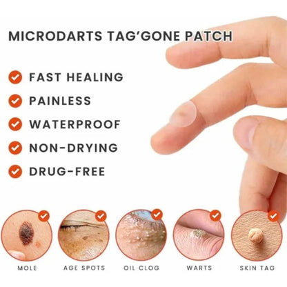 🌿✨ MICRONEEDLE BOTANIC SKIN TAG SOLUTION PATCH ✨🌿 ( BUY 1 GET 1 FREE )