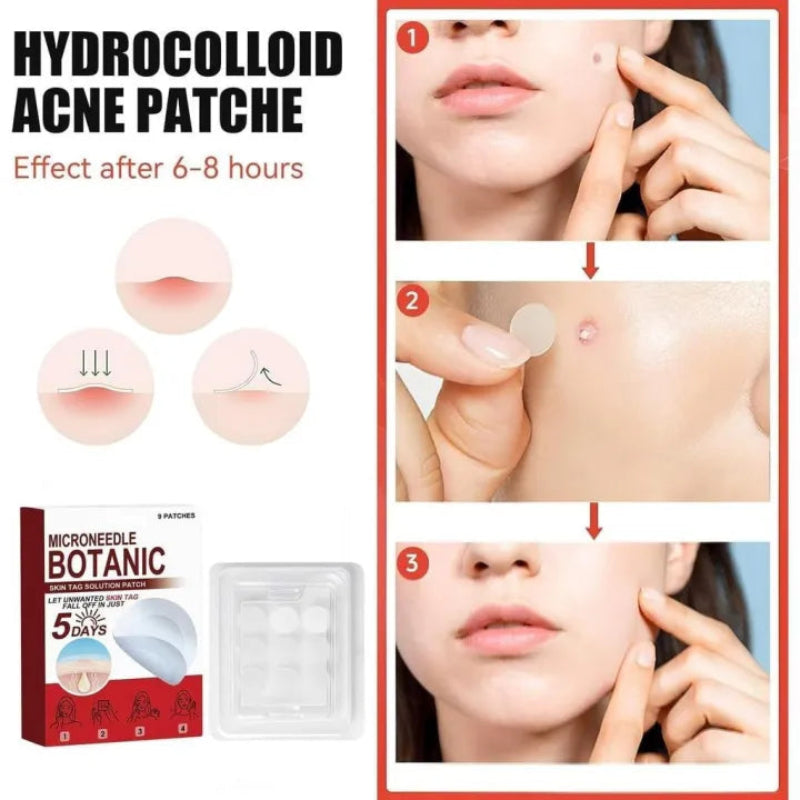 🌿✨ MICRONEEDLE BOTANIC SKIN TAG SOLUTION PATCH ✨🌿 ( BUY 1 GET 1 FREE )