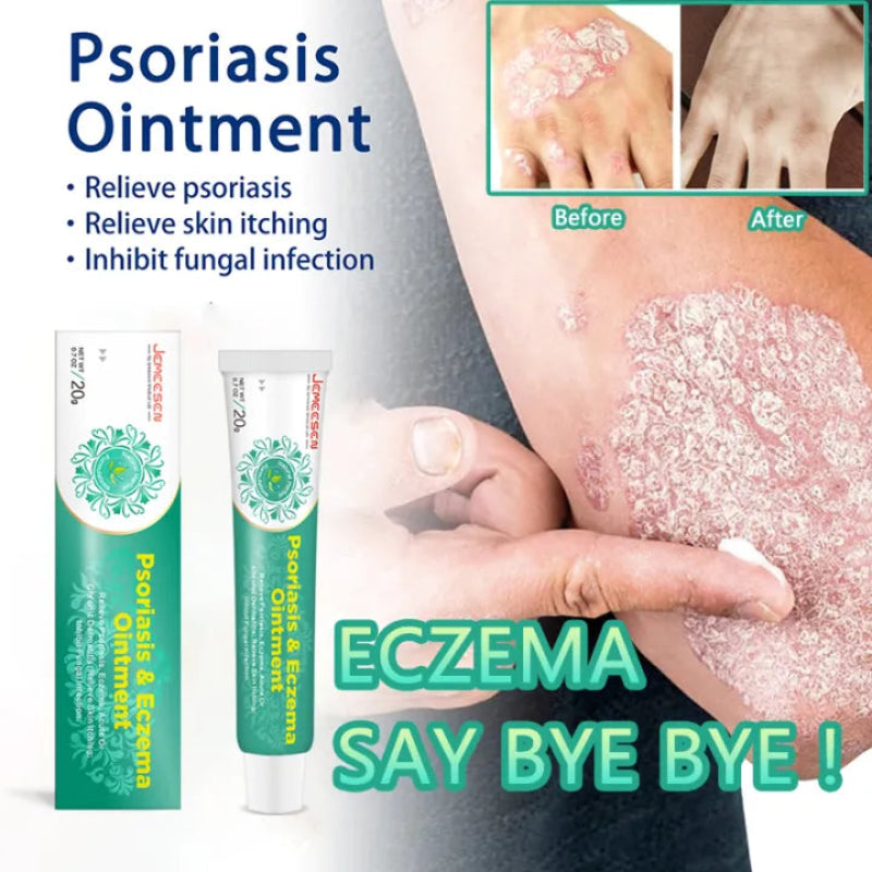 ✨ Psoriasis & Eczema Ointment Cream ✨ ( BUY 1 GET 1 FREE )