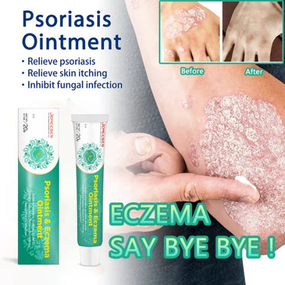 ✨ Psoriasis & Eczema Ointment Cream ✨ ( BUY 1 GET 1 FREE )