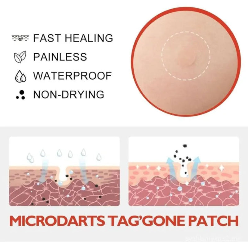 🌿✨ MICRONEEDLE BOTANIC SKIN TAG SOLUTION PATCH ✨🌿 ( BUY 1 GET 1 FREE )