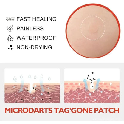 🌿✨ MICRONEEDLE BOTANIC SKIN TAG SOLUTION PATCH ✨🌿 ( BUY 1 GET 1 FREE )