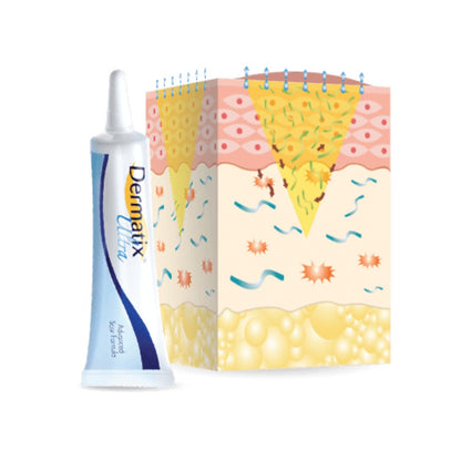 Dermatix Ultra Scar Cream ( BUY 1 GET 1 FREE)