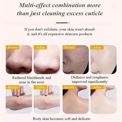 ✨ Yellow Sugar Exfoliating Gel ✨ ( BUY 1 GET 1 FREE )
