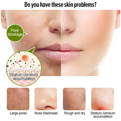 🍊✨ FRUIT ACID PURIFYING PEELING GEL ✨🍋 ( BUY 1 GET 1 FREE )