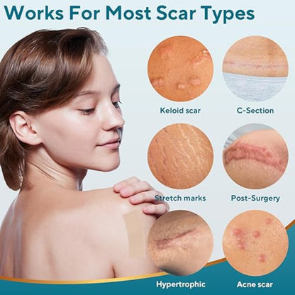 ✨ Scar Removal EFFECTIVE SHEET ✨ ( BUY 1 GET 1 FREE )