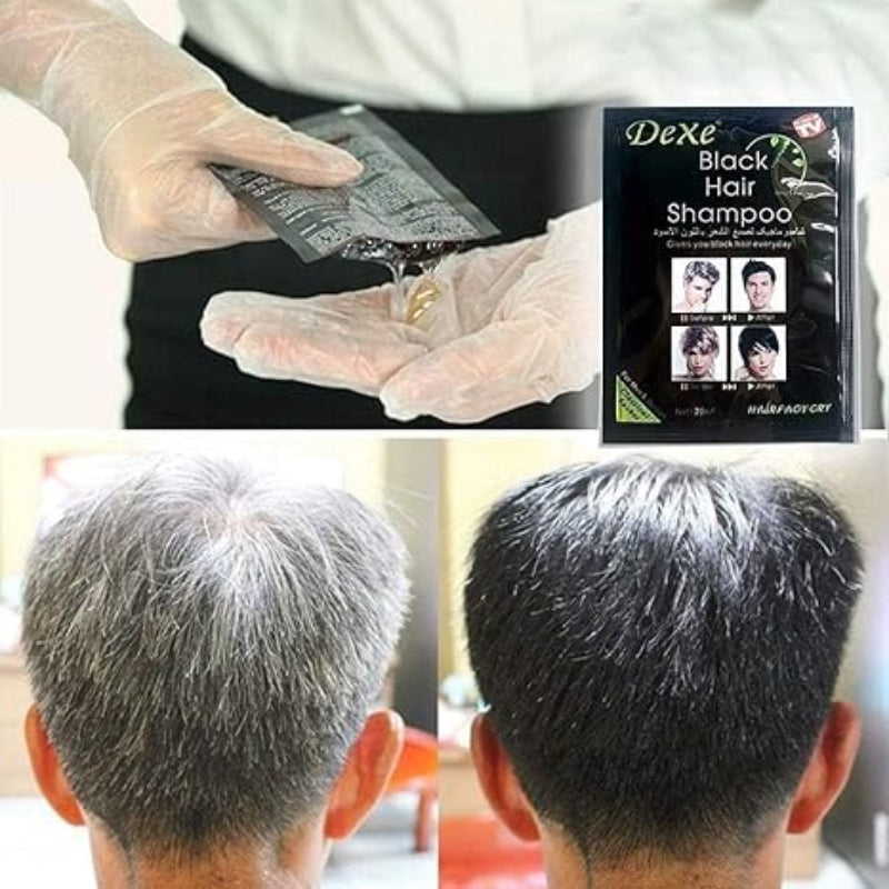 🌟 Dexe Black Hair Shampoo 🌟 ( BUY 1 GET 1 FREE )