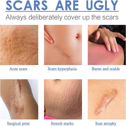 🌟 SOUTH MOON HIGH QUALITY SILICONE SCAR SHEET 🌟 ( BUY 1 GET 1 FREE )