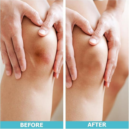 ✨ Vibrum HYDROCOLLOID BANDAGES ROLL ✨ ( BUY 1 GET 1 FREE)