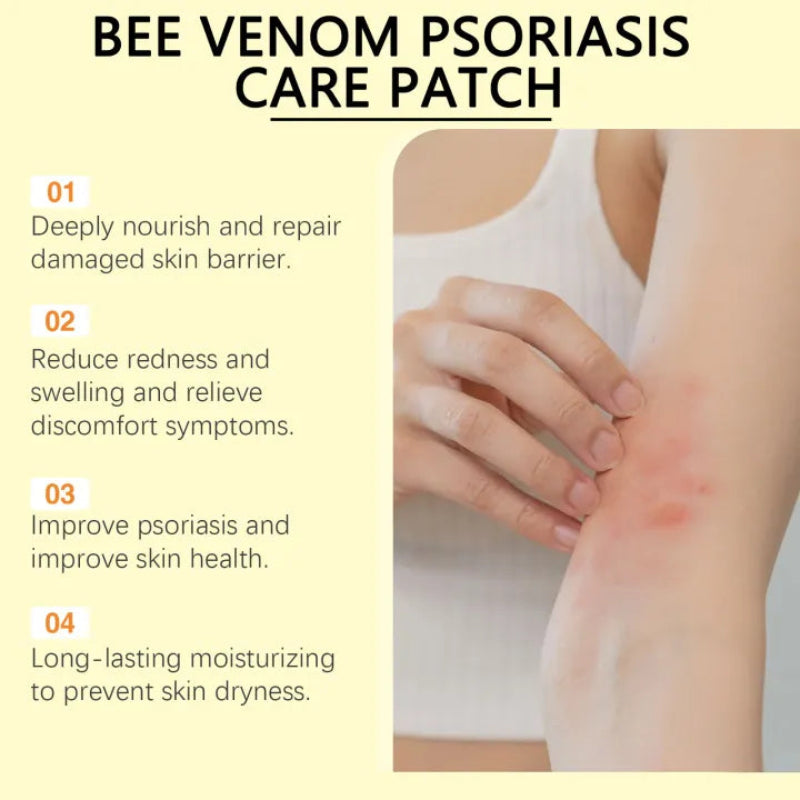 ✨ South Moon Bee Venom Psoriasis Care Patch ✨ ( BUY 1 GET 1 FREE )