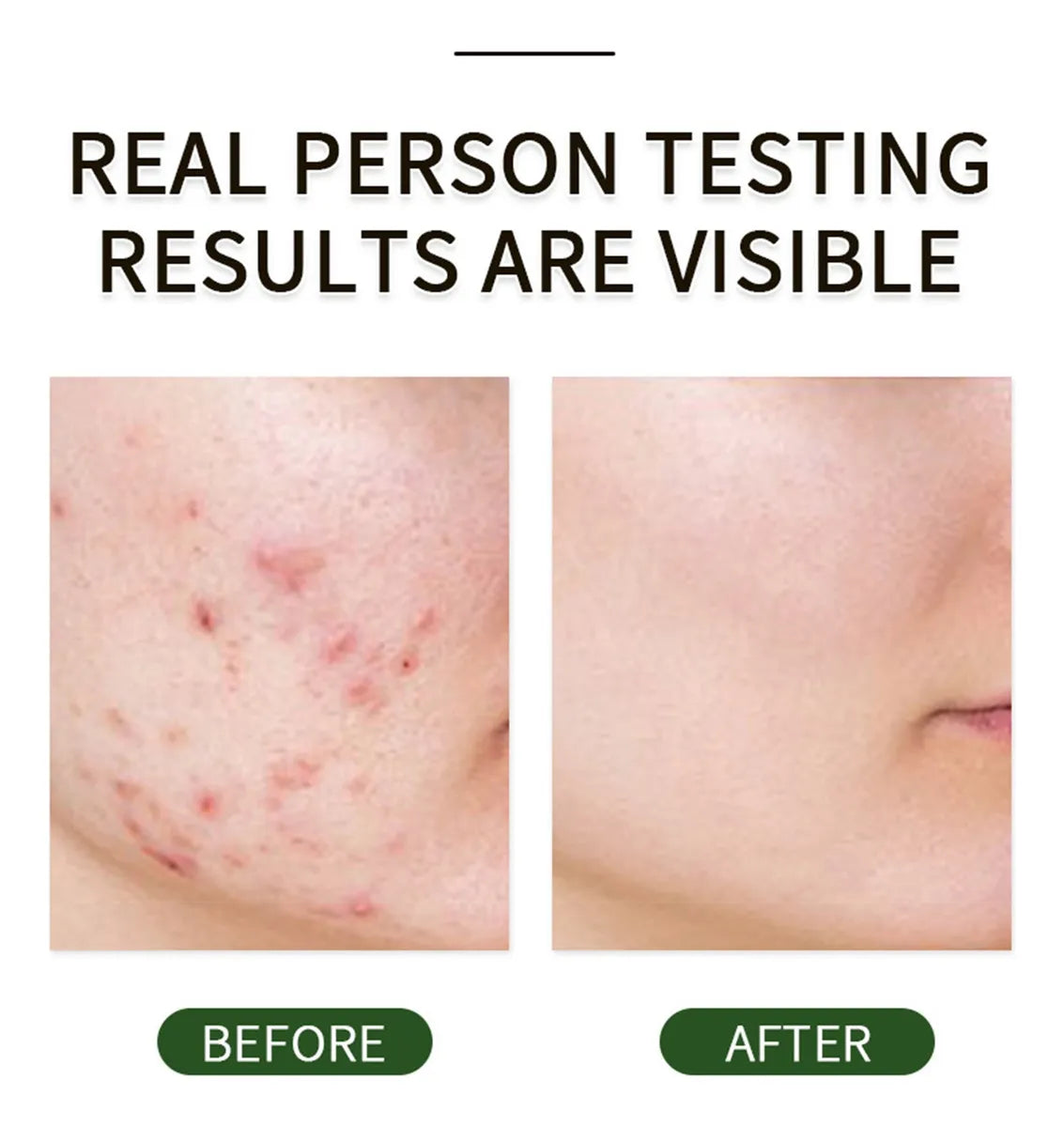 Exfoliate And Pamper Facial Skin Gel ( BUY 1 GET 1 FREE )