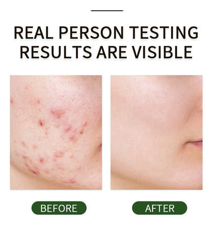 Exfoliate And Pamper Facial Skin Gel ( BUY 1 GET 1 FREE )
