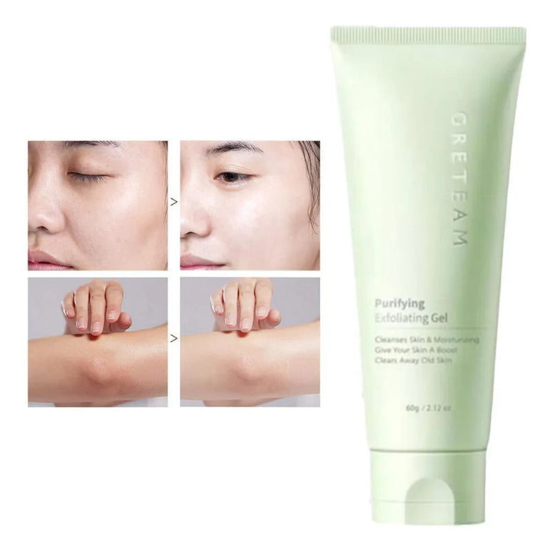 Greateam Purifying Exfoliating Gel ( BUY 1 GET 1 FREE)