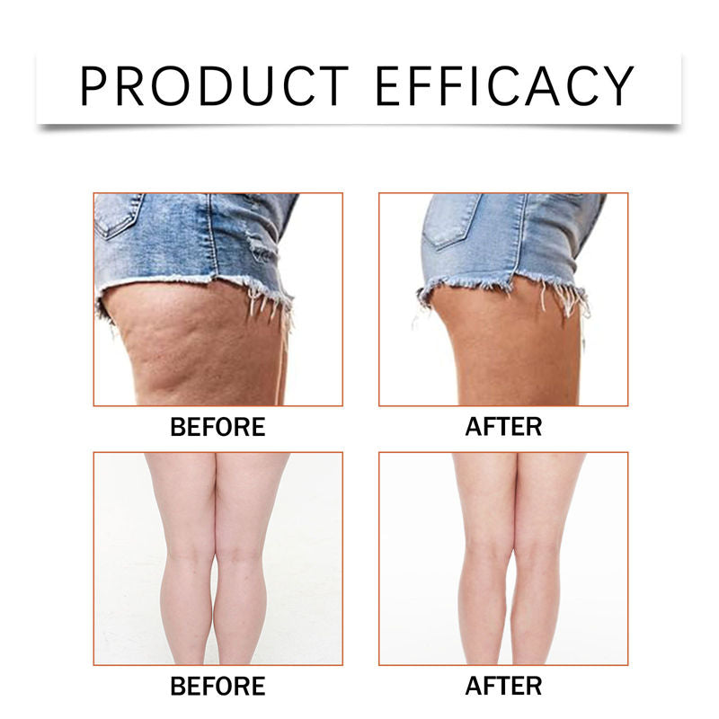 ✨ South Moon Leg Lifting & Glow Patches ✨ ( BUY 1 GET 1 FREE )