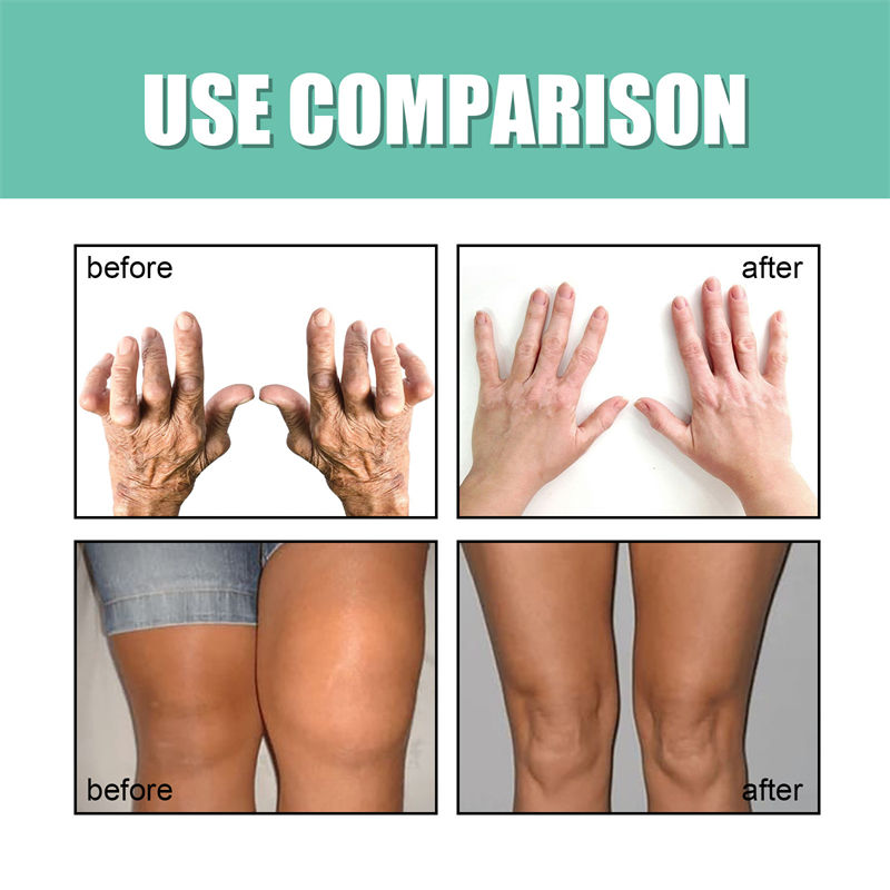🦴 EELHOE INTENSIVE CONCENTRATION CREAM – JOINT &amp; BONE THERAPY 🦴 ( BUY 1 GET 1 FREE )