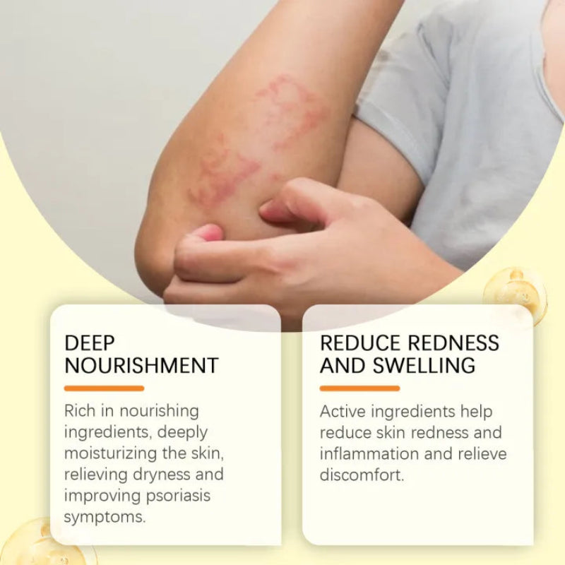 ✨ South Moon Bee Venom Psoriasis Care Patch ✨ ( BUY 1 GET 1 FREE )