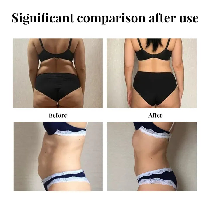 Eelhoe Weight Loss Slimming Patch ( BUY 1 GET 1 FREE )