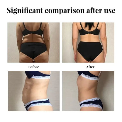 Eelhoe Weight Loss Slimming Patch ( BUY 1 GET 1 FREE )