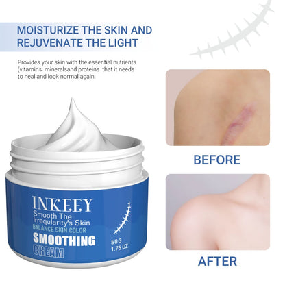 ✨🌿 Inkeey Scar Removal Cream 🌿✨ (BUY 1 GET 1 FREE )