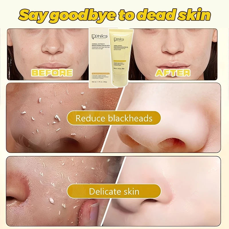 Exfoliating Face Scrub & Peeling Gel ( BUY 1 GET 1 FREE )