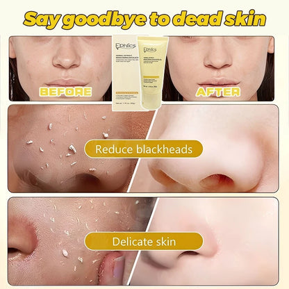 Exfoliating Face Scrub & Peeling Gel ( BUY 1 GET 1 FREE )