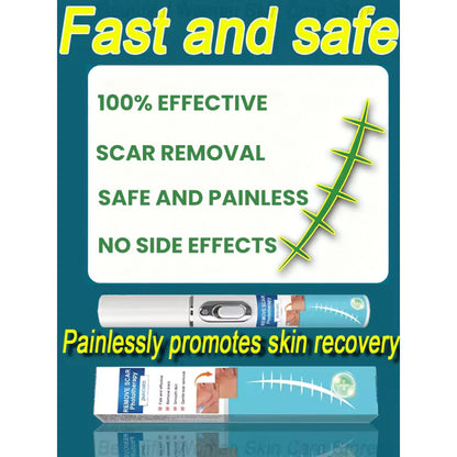 ✨ Laser Scar Removal Pen ✨ ( BUY 1 GET 1 FREE )