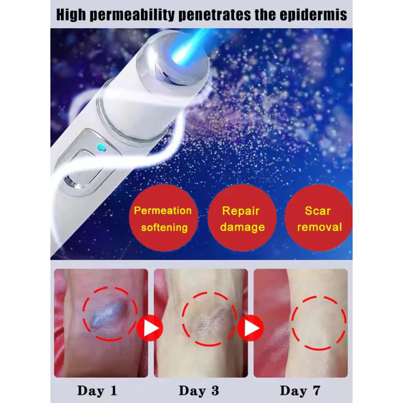 ✨ Laser Scar Removal Pen ✨ ( BUY 1 GET 1 FREE )