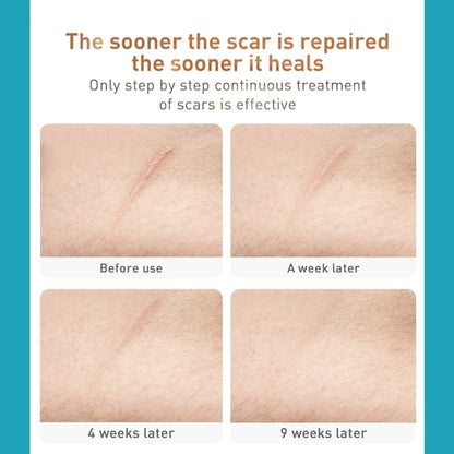 Medical Silicone🔥 scar patch ( BUY 1 GET 1 FREE )