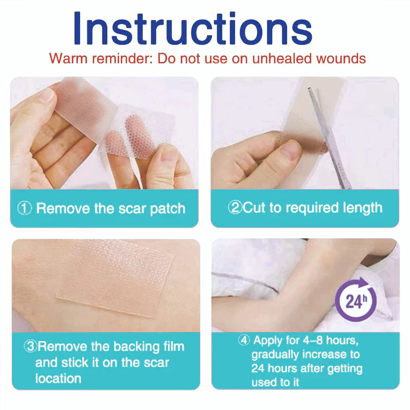 Medical Silicone🔥 scar patch ( BUY 1 GET 1 FREE )