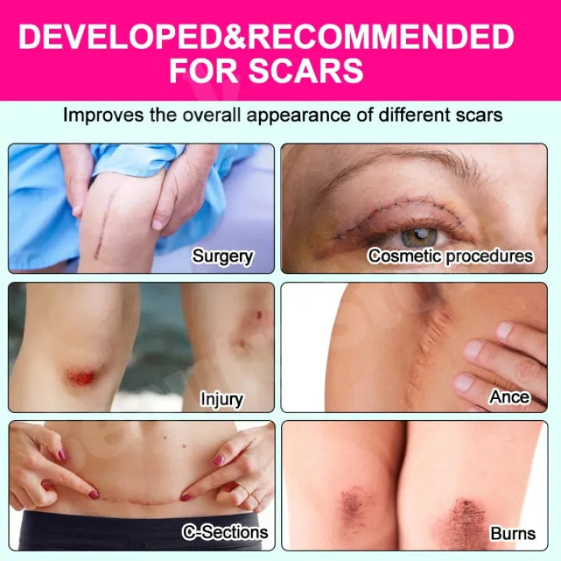 🌿✨ VERDEFY SCAR REMOVER CREAM ✨🌿 ( BUY 1 GET 1 FREE )