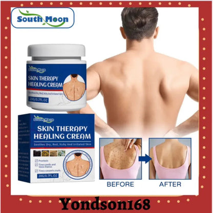 🌿✨ SOUTH MOON SKIN THERAPY HEALING CREAM ✨🌿 ( BUY 1 GET 1 FREE )