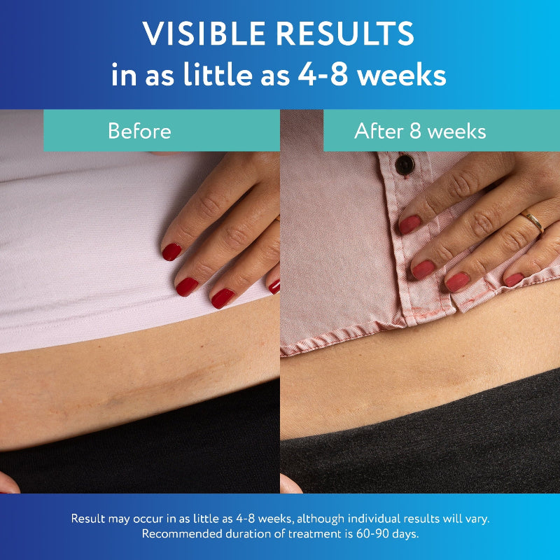✨ ScarAway Medical-Grade Silicone Clear Scar Sheet ✨ ( BUY 1 GET 1 FREE )