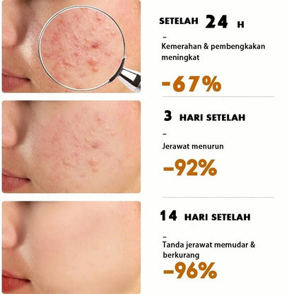 ✨ Men’S HK Moisturiser Whitening Cream ✨( BUY 1 GET 1 FREE )
