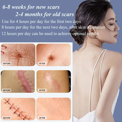 Hons Medical Silicone scar sheet ( BUY 1 GET 1 FREE )